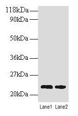 TAGLN Antibody