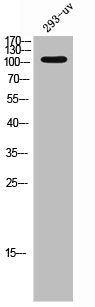 EPHA3 Antibody