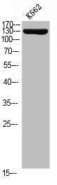 Phospho-ERBB2 (Y1112) Antibody