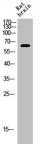 Phospho-ESR1 (S106) Antibody