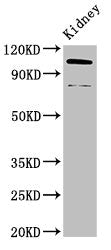 ACTN4 Antibody