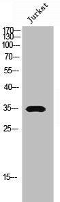 OR5AR1 Antibody