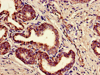 FAM3B Antibody