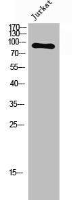 Phospho-FGFR4 (Y642) Antibody
