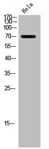 Phospho-FOXO1 (S256) Antibody