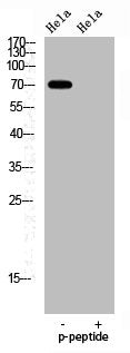 Phospho-FOXO1 (S329) Antibody