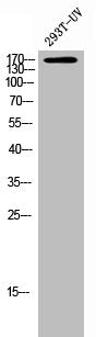 Phospho-FLT3 (Y842) Antibody
