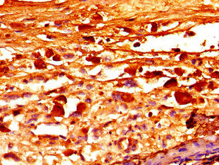 FBN1 Antibody
