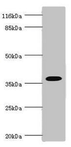 FBP1 Antibody