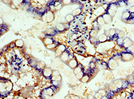FBXW4 Antibody