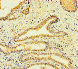 FCER1A Antibody