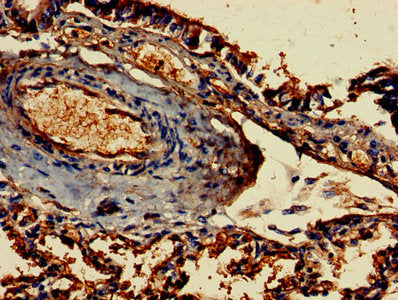 FCER1G Antibody