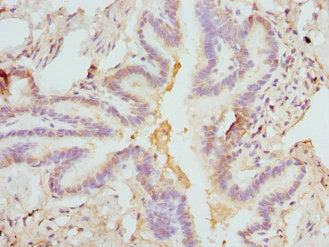 FCN1 Antibody