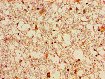 FGF22 Antibody