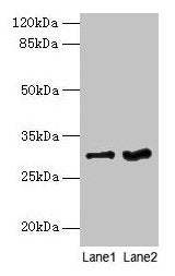 FGFR1OP2 Antibody