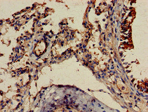 FGR Antibody