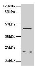FIBP Antibody
