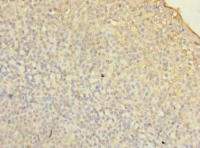 FMNL1 Antibody