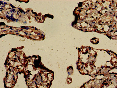 RHOA Antibody