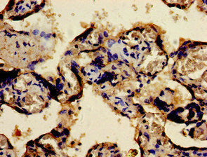 FOSB Antibody