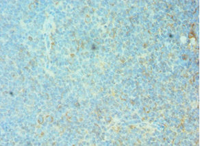 FOSL1 Antibody