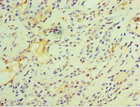 FOSL2 Antibody