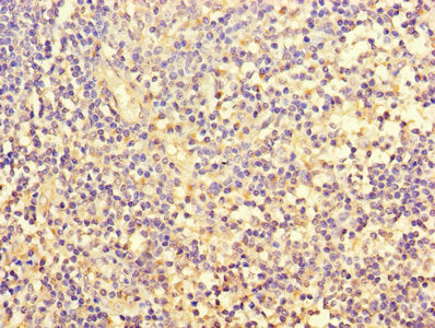 FOSL2 Antibody