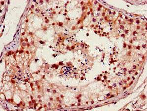 FOXM1 Antibody