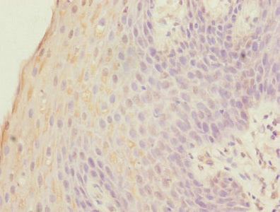 FOXP1 Antibody