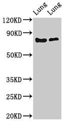 FOXP1 Antibody