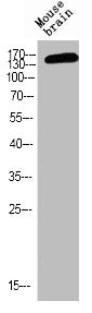 Phospho-GRIN2B (Y1474) Antibody