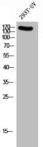 Phospho-GRIN2B (Y1336) Antibody