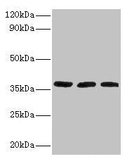 FTSJ1 Antibody