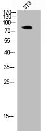 Phospho-GYS1 (S645) Antibody