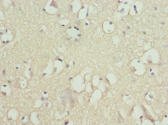 FXYD2 Antibody