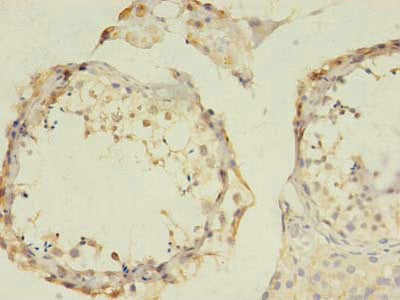 GABRB2 Antibody