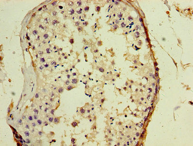 GAGE5 Antibody