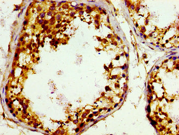 GAK Antibody