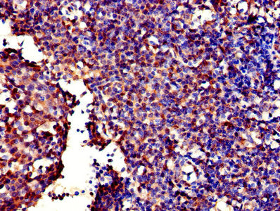 GALT Antibody