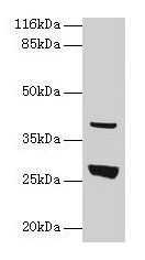 Gamt Antibody