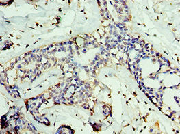 GAN Antibody
