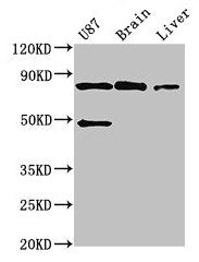 GARS Antibody