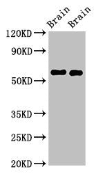 GAS7 Antibody