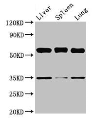 Gba Antibody