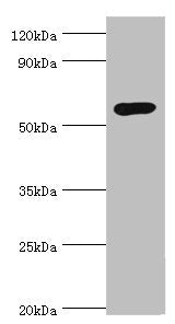 GCK Antibody