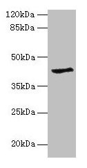 GDAP1L1 Antibody