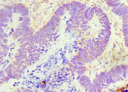 GDF5 Antibody