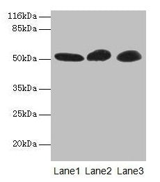 GDI2 Antibody
