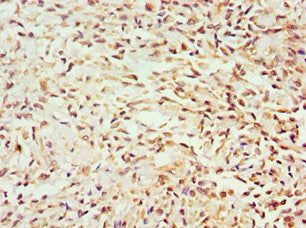 GEM Antibody
