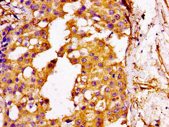 GGCX Antibody